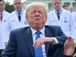 Shock and Concern as U.S. President Involved in Sudden Motorcade Accident